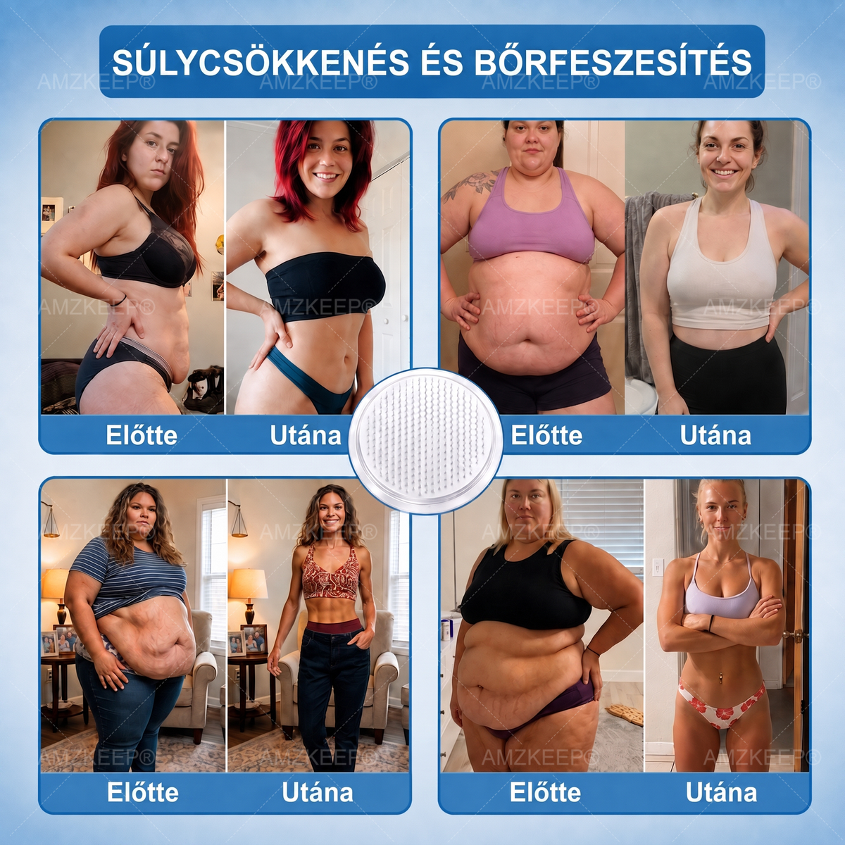 𝐀𝗠𝒁𝑲𝗘𝑬𝙋® 𝐀𝗠𝗣𝑲𝐌𝗼𝗿𝗶𝗻𝗴𝗮𝐁𝗲𝗿𝗯𝗲𝗿𝗶𝗻 𝟏𝟎-𝗮𝘇-𝟏 𝐌𝗲𝘁𝗮𝗯𝗼𝗹𝗶𝗸𝘂𝘀 𝐓á𝗺𝗼𝗴𝗮𝘁á𝘀 𝐍𝗮𝗻𝗼 𝐌𝗶𝗸𝗿𝗼𝘁ű𝘀 𝐓𝗮𝗽𝗮𝘀𝘇 🇭🇺 (𝗡𝗮𝗽𝗼𝗻𝘁𝗮 𝗲𝗴𝘆𝘀𝘇𝗲𝗿𝗶 𝗵𝗮𝘀𝘇𝗻á𝗹𝗮𝘁, 𝗹á𝘁𝘃á𝗻𝘆𝗼𝘀 𝘃á𝗹𝘁𝗼𝘇á𝘀 𝟳 𝗻𝗮𝗽 𝗮𝗹𝗮𝘁𝘁) ✅ 𝗧ú𝗹𝘀ú𝗹𝘆, 𝗹𝗮𝘇𝗮 𝗯ő𝗿, 𝘃é𝗿𝗰𝘂𝗸𝗼𝗿-𝗲𝗴𝘆𝗲𝗻𝘀ú𝗹𝘆, 𝗮𝗹𝘃á𝘀𝗶 𝗽𝗿𝗼𝗯𝗹é𝗺á𝗸, í𝘇ü𝗹𝗲𝘁𝗶 𝗽𝗮𝗻𝗮𝘀𝘇𝗼𝗸 é𝘀 𝗲𝗴𝘆é𝗯 𝘁𝗲𝗿ü𝗹𝗲𝘁𝗲𝗸 𝘁á𝗺𝗼𝗴𝗮𝘁á𝘀á𝗿𝗮